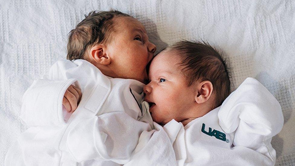 Rare identical quadruplets born in Australia