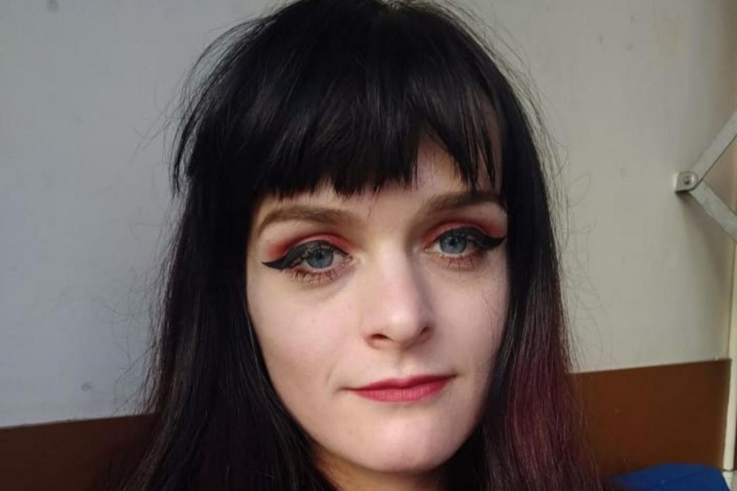 I had to stop modelling because I kept passing out from crippling endometriosis
