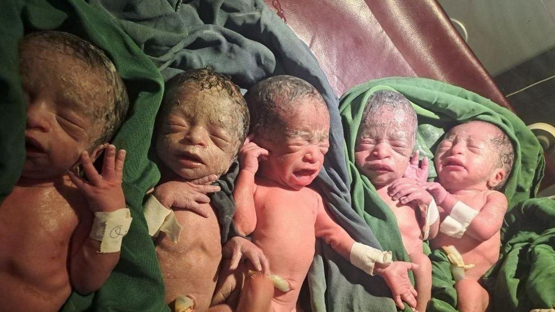 Rare identical quadruplets born in Australia