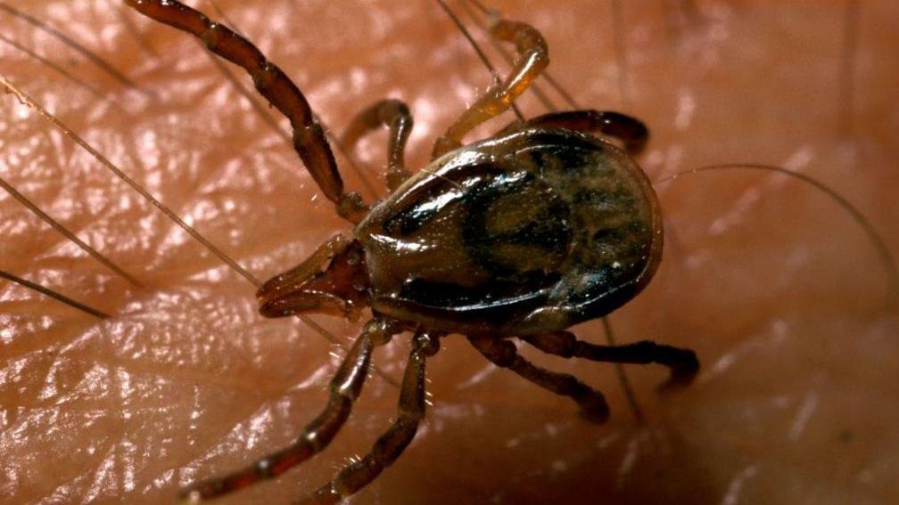 'If only people knew what a tick could do' - the deadly meat allergy caused by tick bites