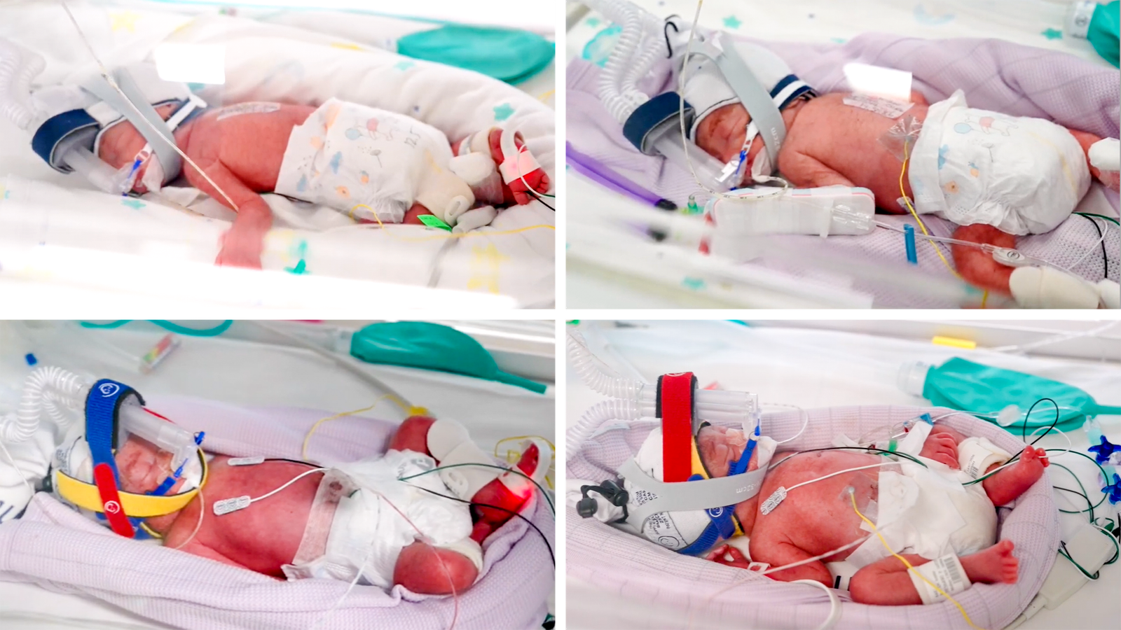 Rare identical quadruplets born in Australia