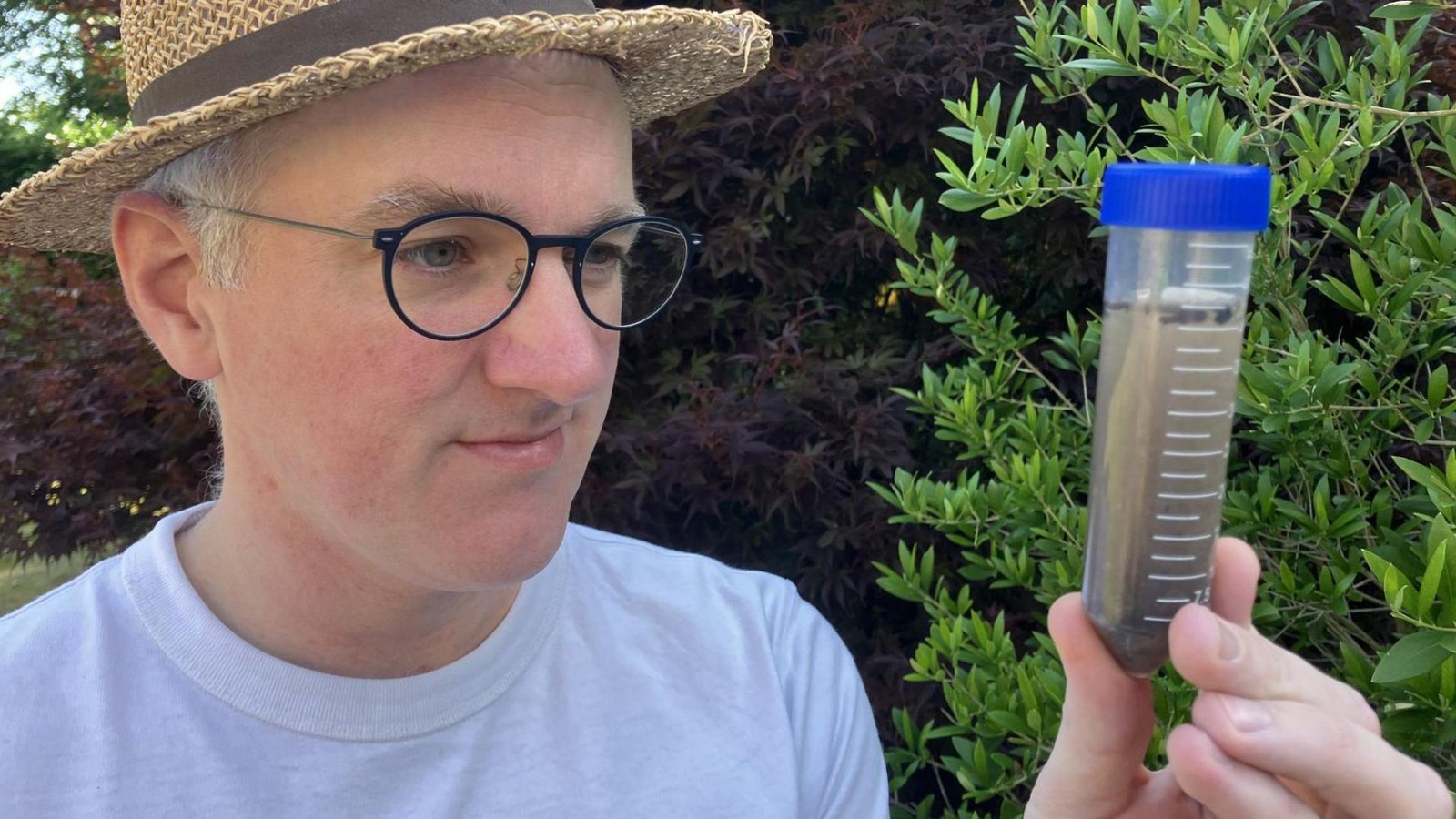 What's driving men to get penis fillers, despite the risks?
