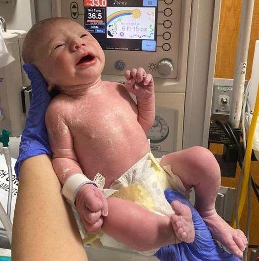 Woman has pioneering womb surgery to fix 'miracle' baby with intestines outside its body