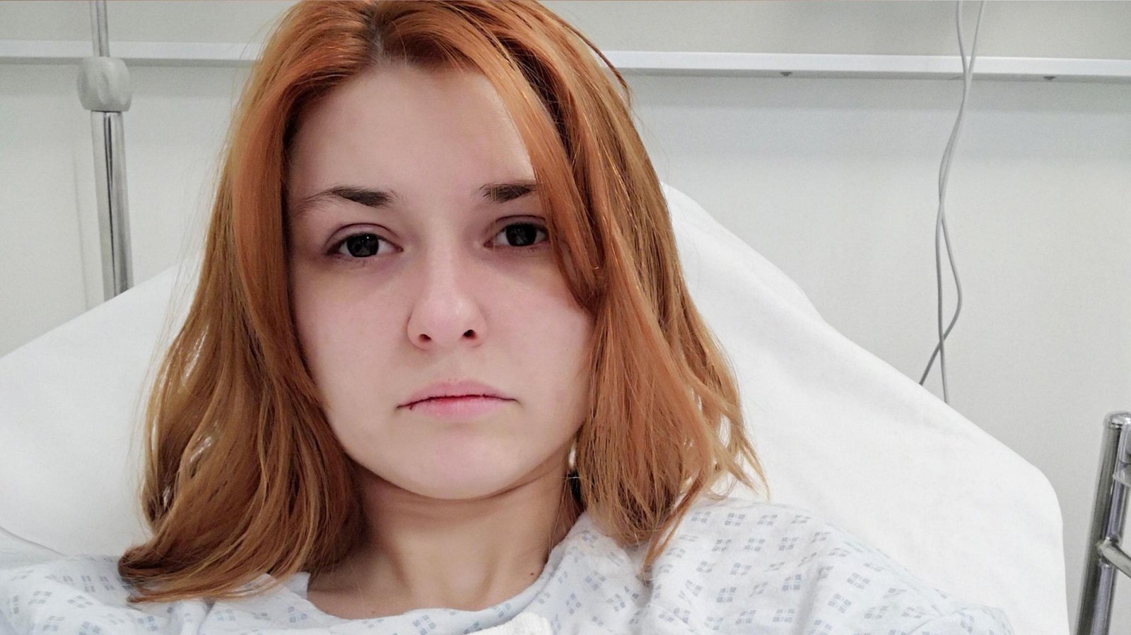'You are not alone with endometriosis pain'
